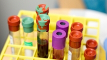 Liquid biopsy market to reach $11.3b by 2029