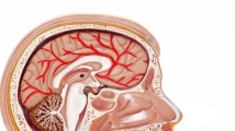 What lies ahead in the acute ischemic stroke therapeutics market?