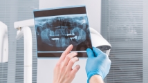 Dental radiology equipment market to grow by $2.45b by 2028